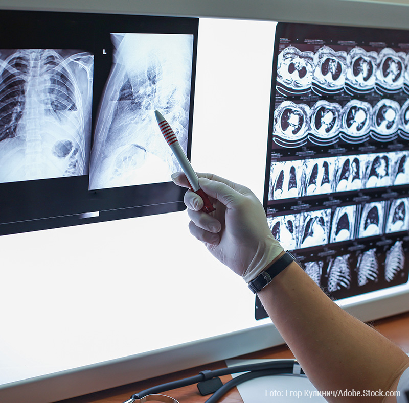 Computertomograph in Engelskirchen